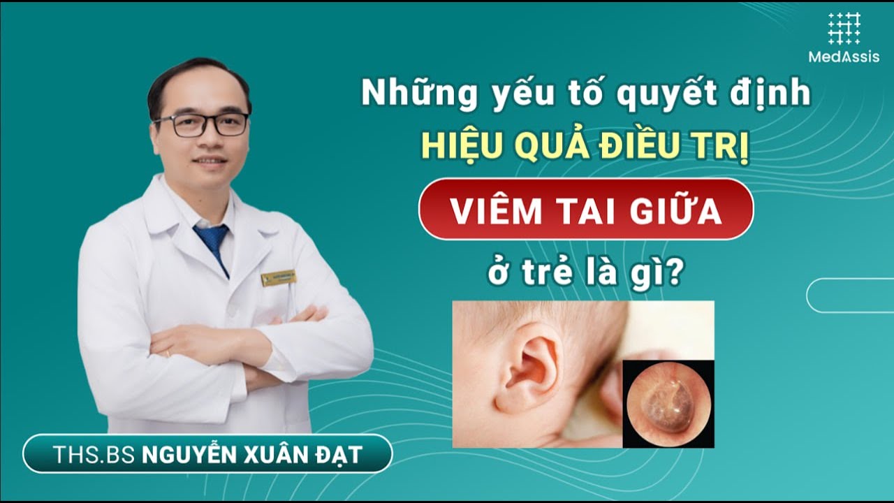 👂👶 Những yếu tố quyết định hiệu quả điều trị viêm tai giữa ở trẻ