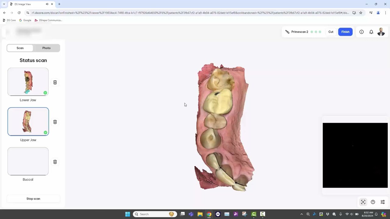 Status Scan Workflow with Primescan 2