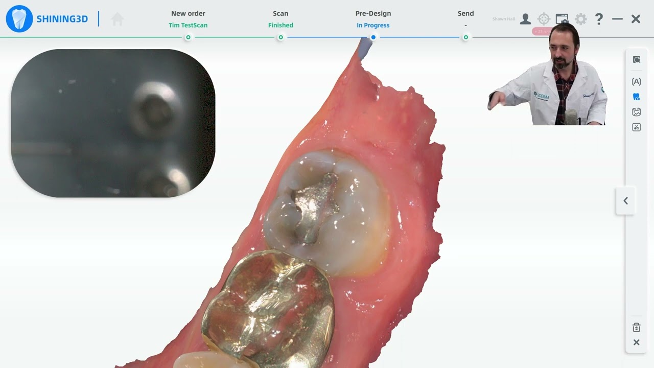 Use Your Intra Oral Scanner in Hygiene with the Aoralscan 3 IOS and the NEW ConsulOS AI Powered Tool