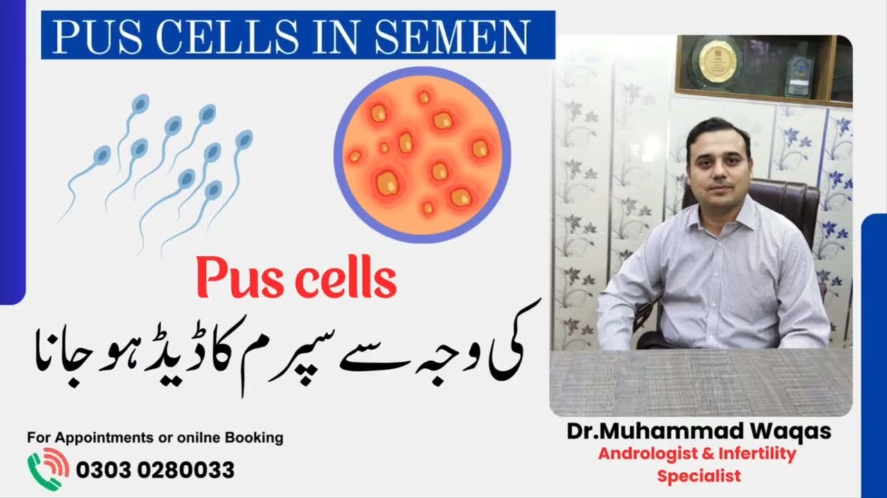 PUS Cells in Semen| 4-5 Pus cells in Semen Are  Normal? |
