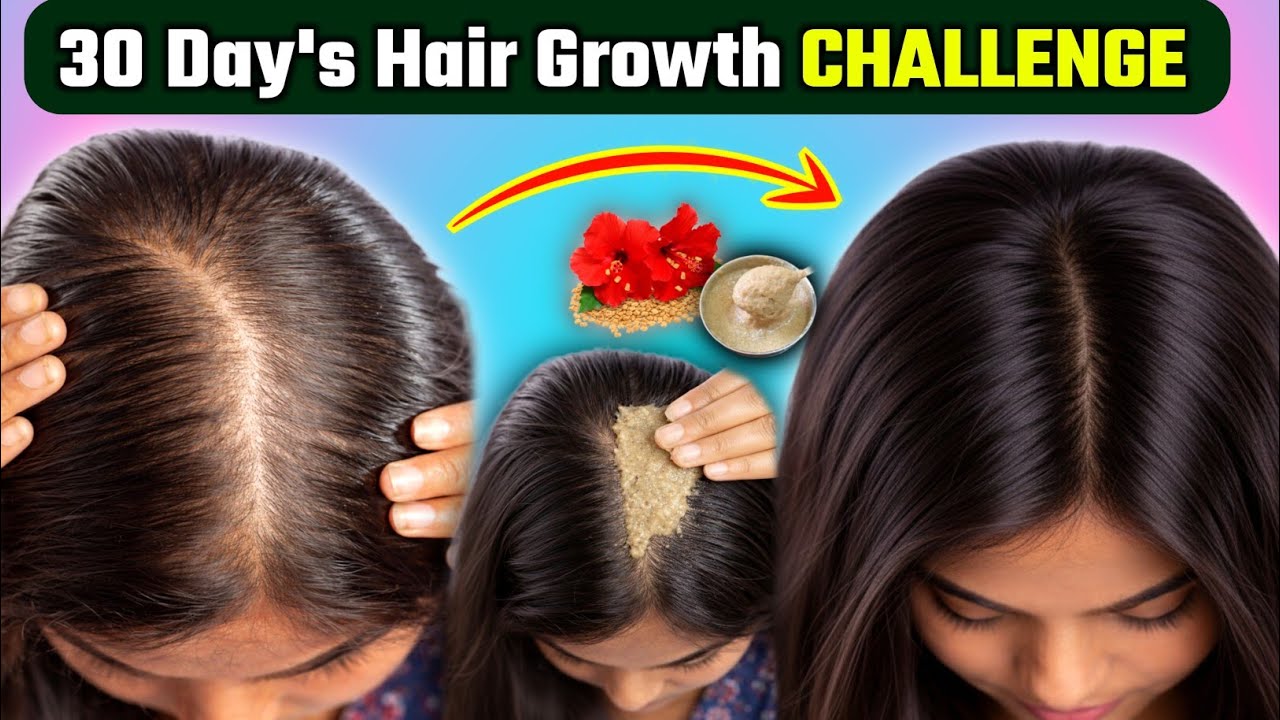 30 Day's Hair Growth Challenge 😉 | How To Grow Hair at Home 🌿 hairfall kaise roke | hairfall ka ilaj