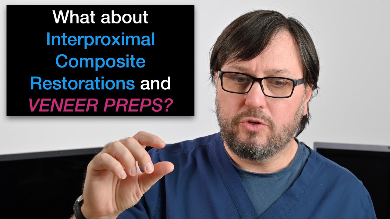 What about moderate sized interproximal composite restorations with porcelain veneer preparations?