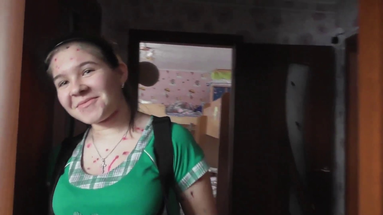 ДАРИНА ПЛАЧЕТ, ОТКАЗЫВАЕТСЯ СТАВИТЬ БРЕКИТЫ. ЗАТО АЛИНА СОГЛАСНА) 3.12.19.