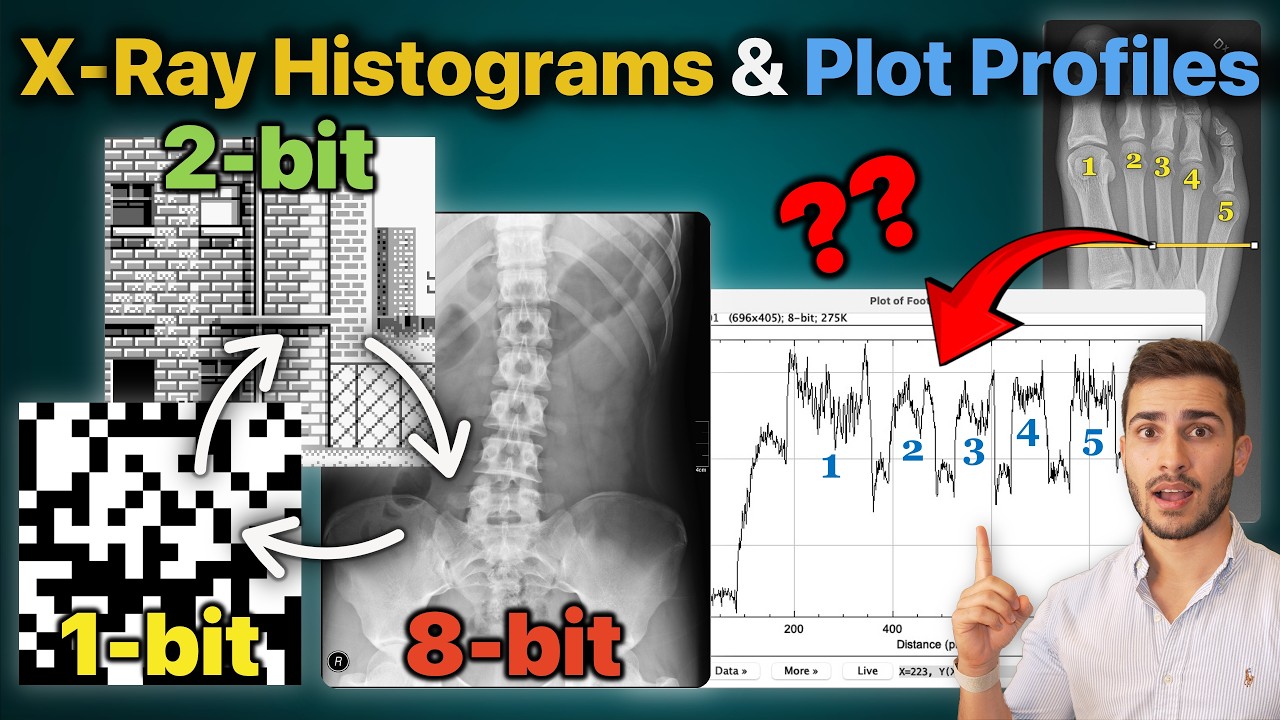 X-Ray Histogram and Plot Profiles: Explained! | Everything You Need to Know