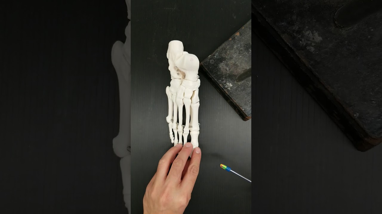 Tarsals, metatarsals, phalanges of the pedal region (feet) and arches