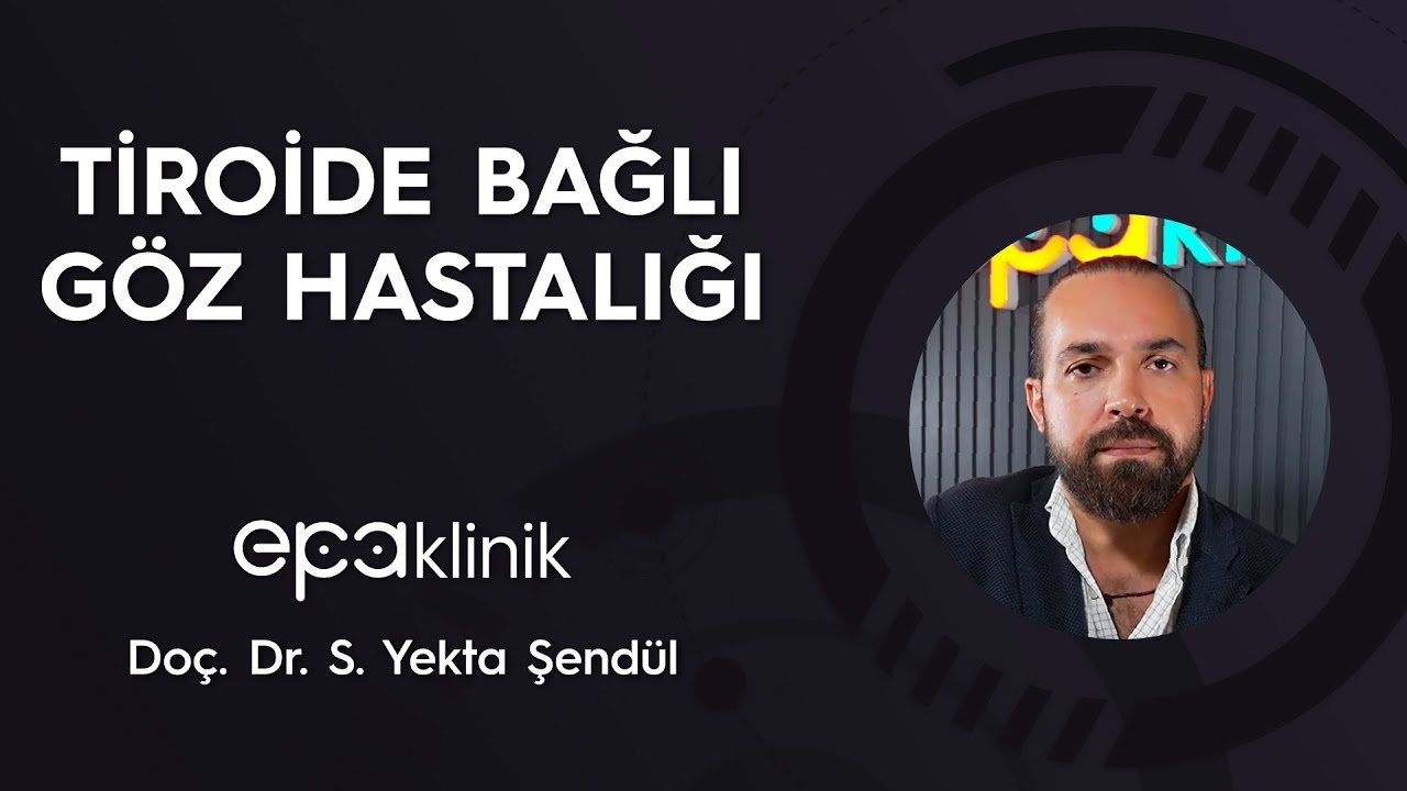 Tiroide Bağlı Göz Hastalığı
