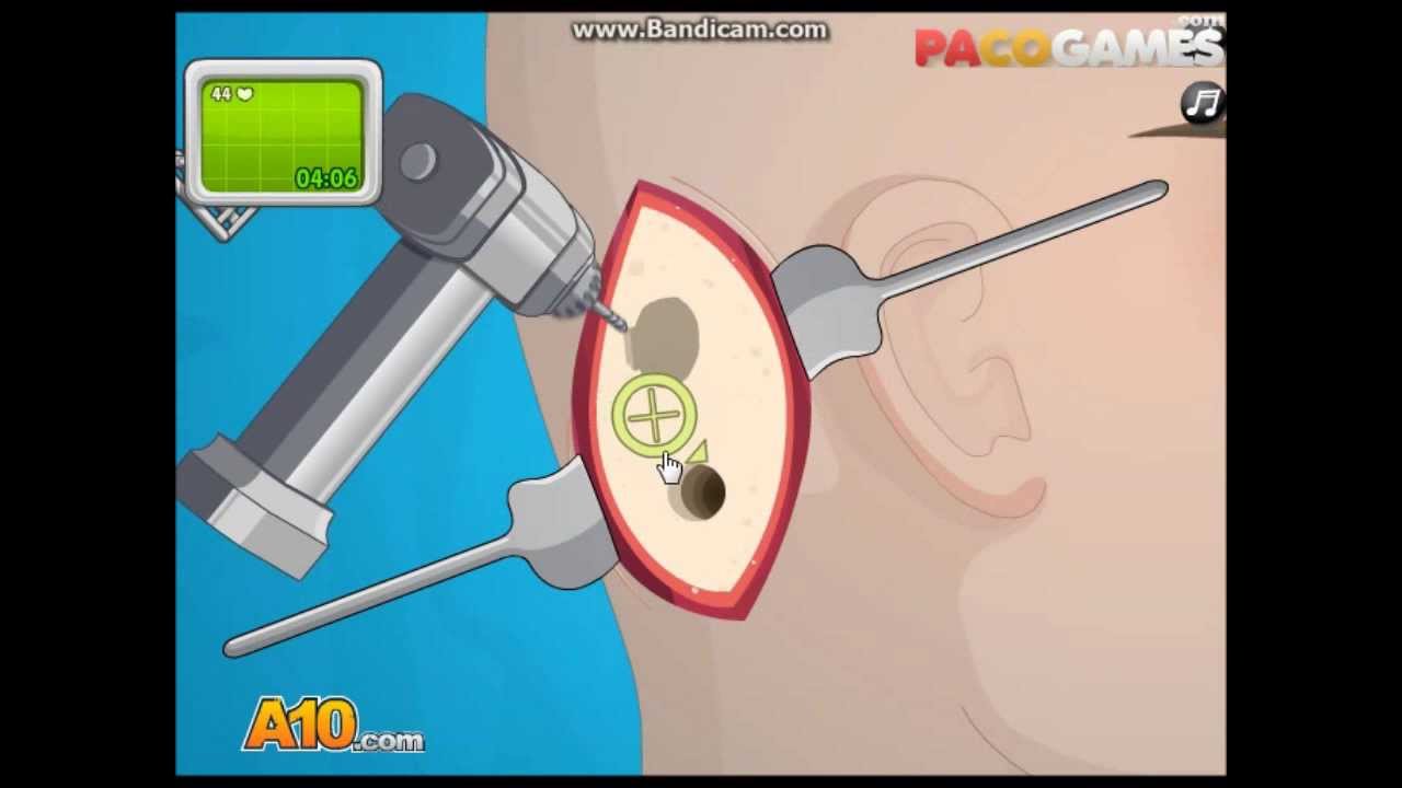 Restoring Hearing for Billy - Gameplay Recording of Operate Now: Ear Surgery