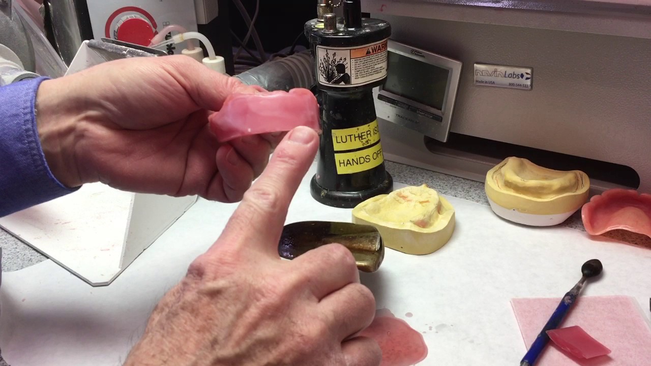 SBOR Part II wax rim