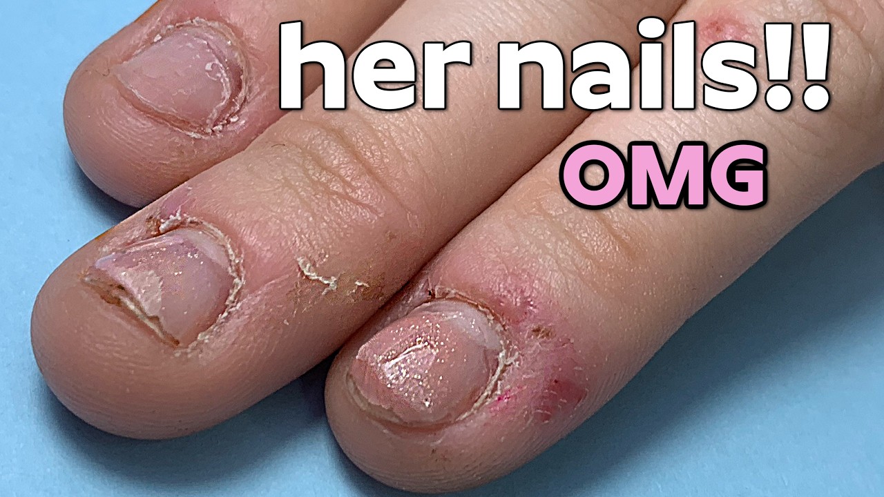 Watch Me Transform These Severely Bitten & Short Nails