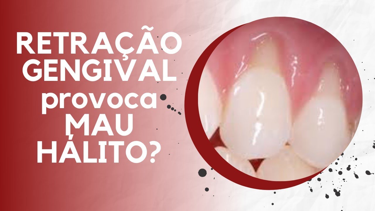 Retração GENGIVAL provoca Mau Hálito?