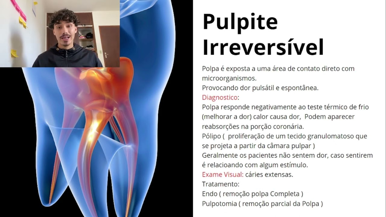 Pulpite Revers&iacute;vel e Irrevers&iacute;vel. IMPOSS&Iacute;VEL CONFUNDIR
