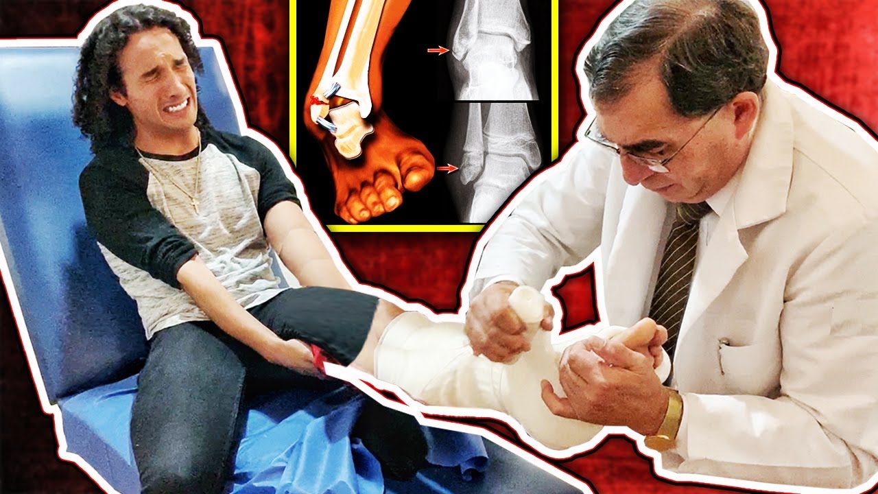 Terminé en el Hospital - Todo sobre mi accidente - ¿Cirugía?