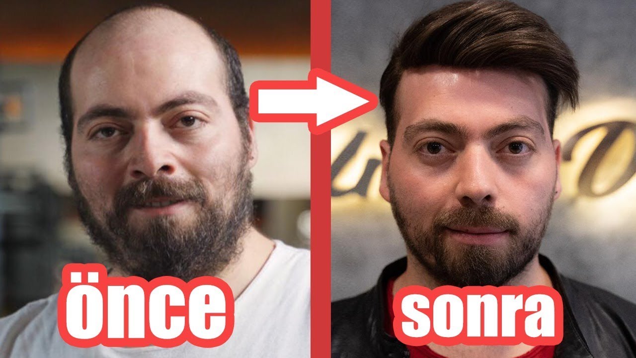 30 GÜNDE 10 YAŞ GENÇLEŞTİM!(İNANILMAZ DEĞİŞİM)