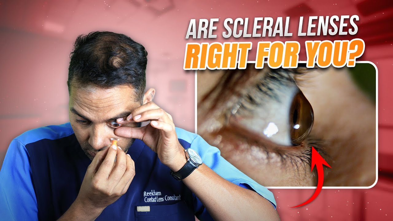 What is Scleral Lenses? | Reekham Lal Talks About Scleral Lens