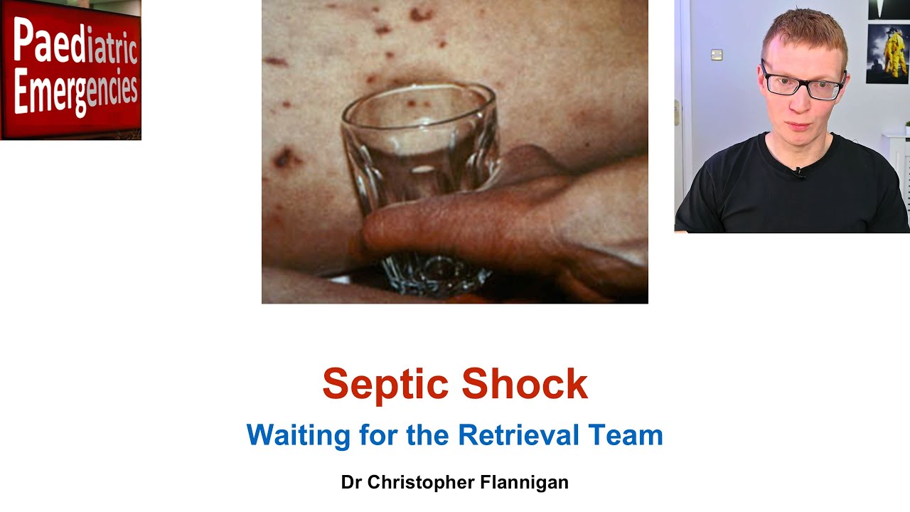 Septic Shock - Paediatric Emergencies 2025