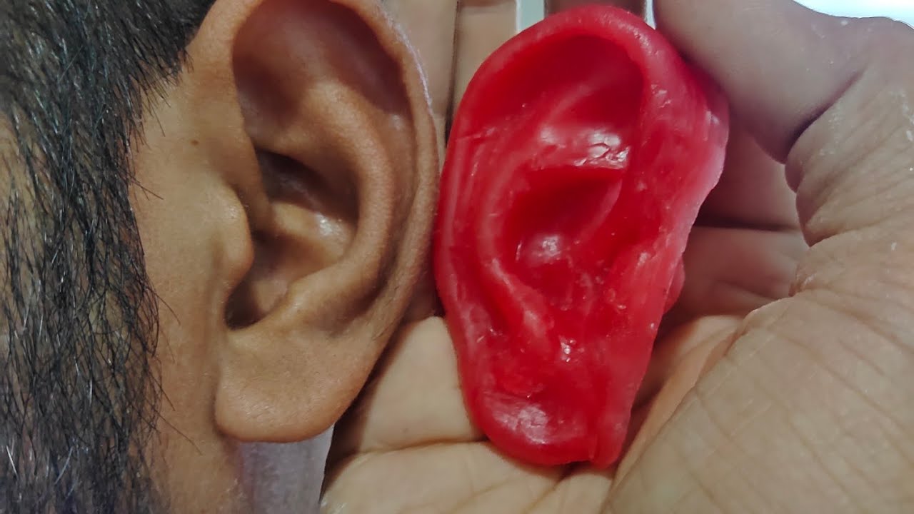 Wax Sculpting For Artificial Ear Prosthesis | Inspire Health Care | Dr. Hiren Babariya