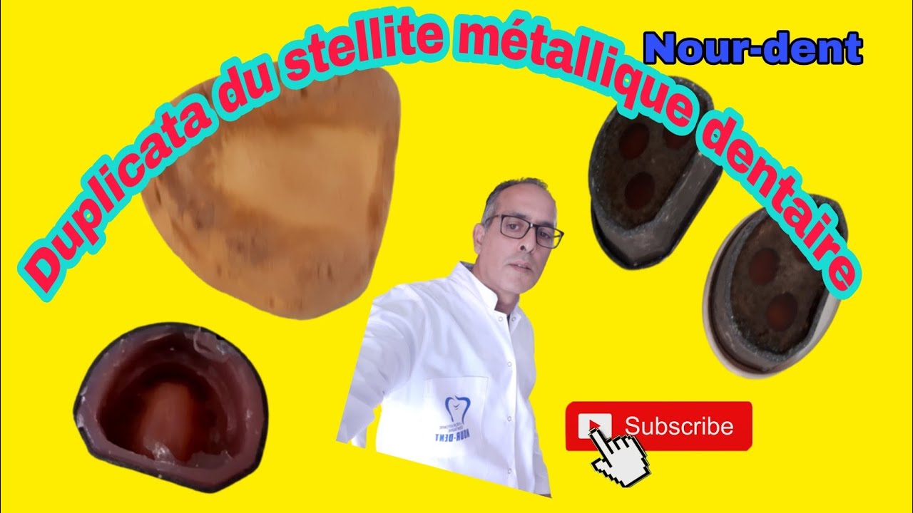 Duplicata du stéllite dentaire métallique. @NoureddineVlogsBr