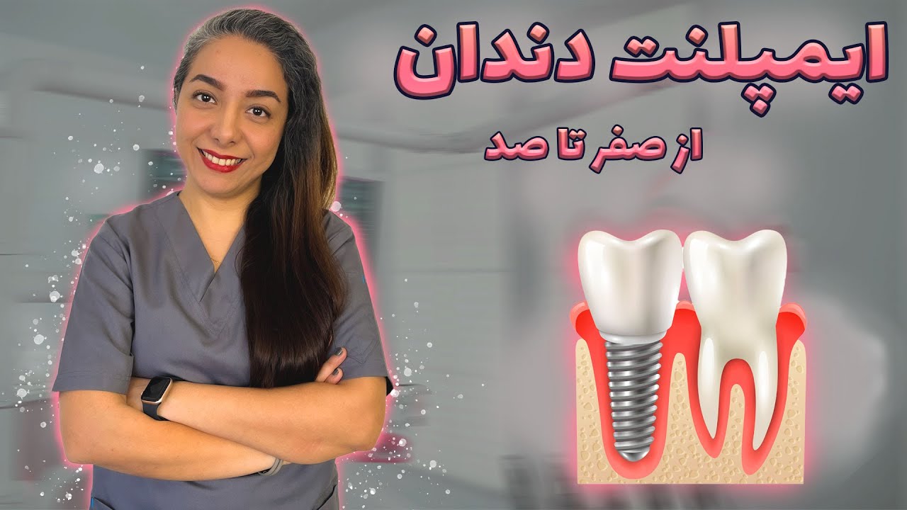 ایمپلنت دندان از صفر تا صد | راهنمای کامل حتی در صورت تحلیل استخوان