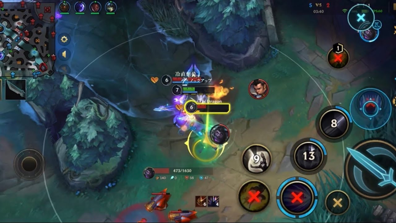 top irelia vs Dr.Mundo