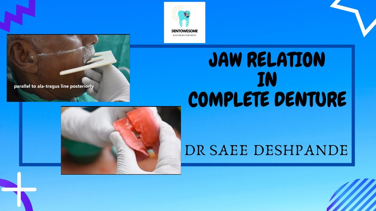 JAW RELATION IN COMPLETE DENTURE | MOUNTING IN ARTICULATOR | PROSTHODONTICS