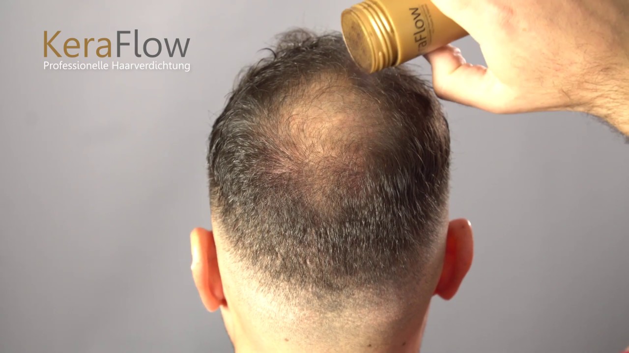 Dichteres Haar in 30 Sekunden!!! KeraFlow Streuhaar, Sch&uuml;tthaar, Haarverdichtung! Top Hair Fibers!