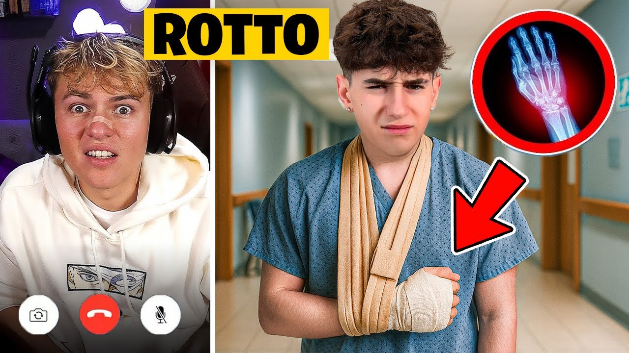Scherzo del BRACCIO ROTTO! 😱 REAZIONI INCREDIBILI in Villa con gli Amici!