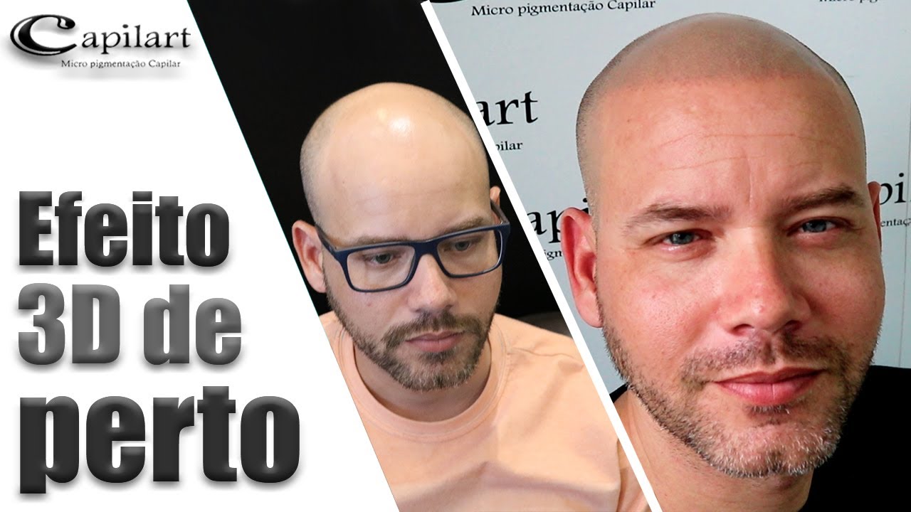 ZOOM NO EFEITO 3D Micropigmentação capilar | Capilart