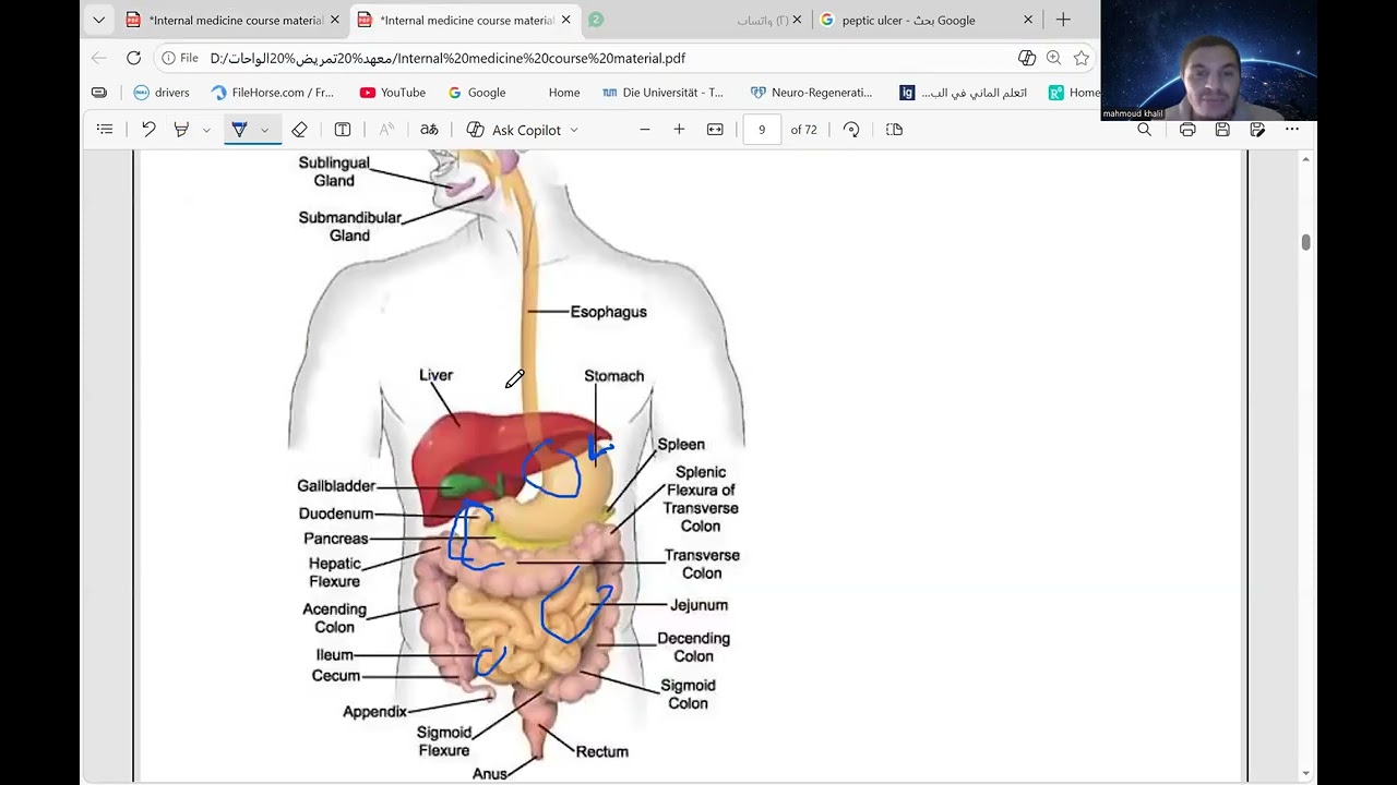 باطنة اولى معهد تمريض الواحات وامبابة ترم تاني peptic ulcer and hepatitis  جزء اول