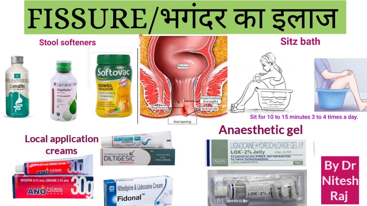 Anal fissure, Anal pain, anal bleeding,anal fissure vs piles,causes and treatment by #drniteshraj