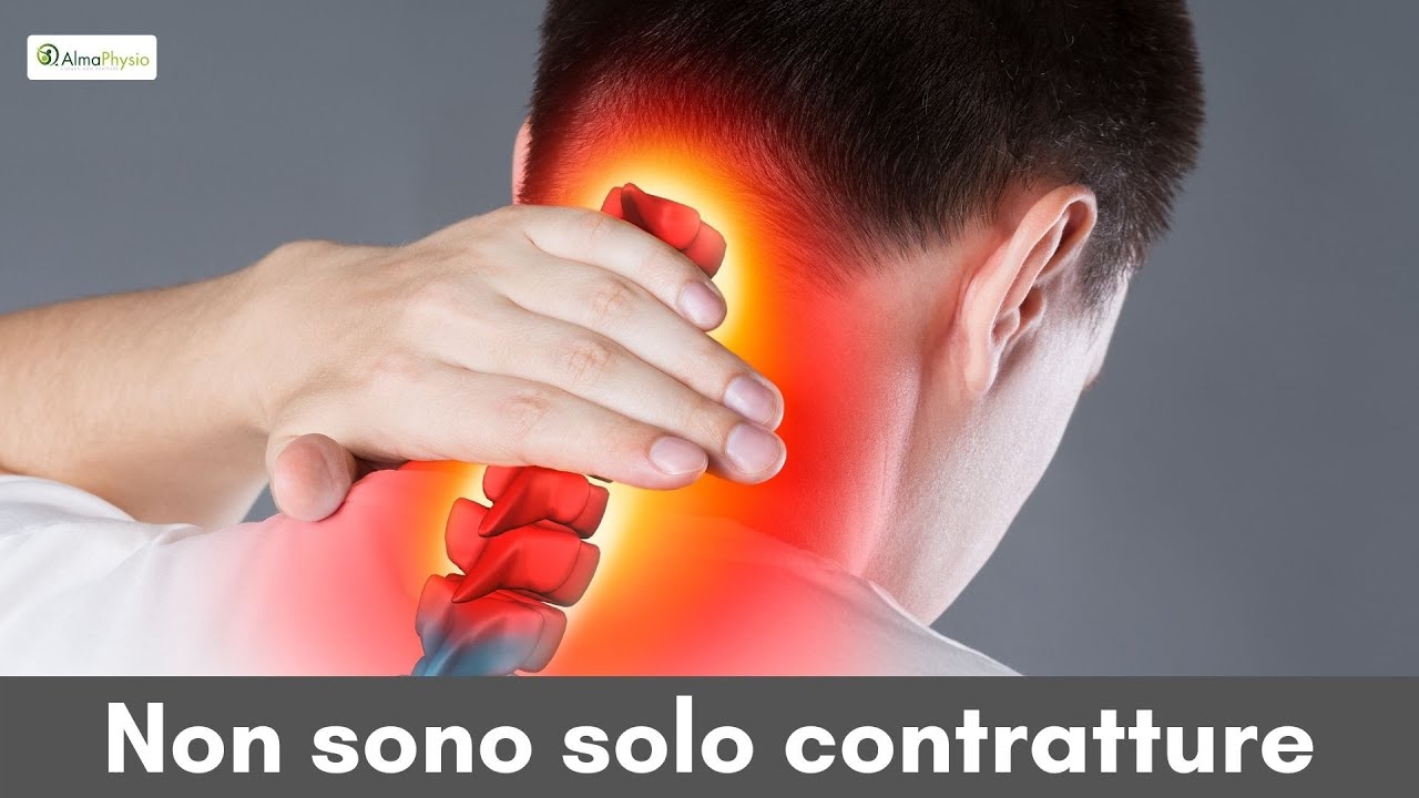 😩 Radicolopatia cervicale: cause ed esercizi