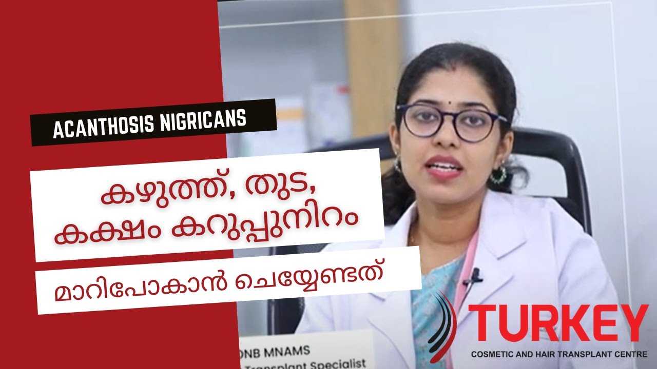 കഴുത്ത്, തുട, കക്ഷം കറുപ്പുനിറം (Acanthosis Nigricans) മാറിപോകാൻ  - Dr Nikhila Recommends