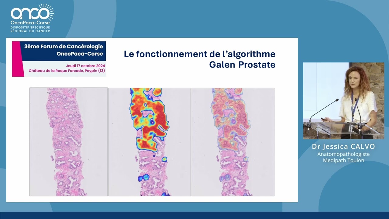 L'IA en anatomopathologie