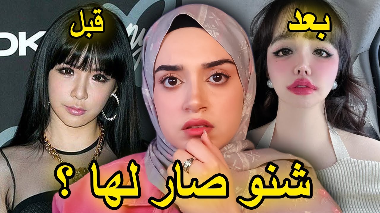 شنو صار ببارك بوم؟ 💔 القصة الحقيقية لنجمة فرقه  2NE1