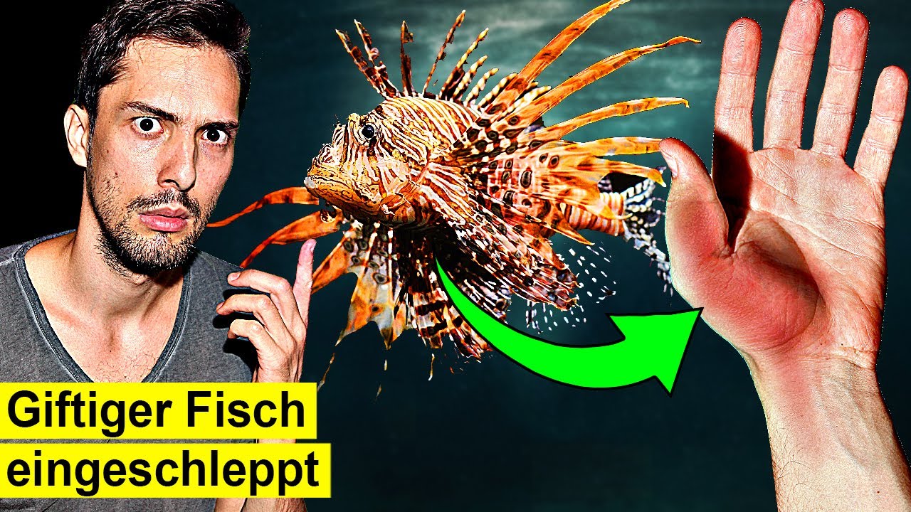 Das passiert, wenn dich der Feuerfisch sticht