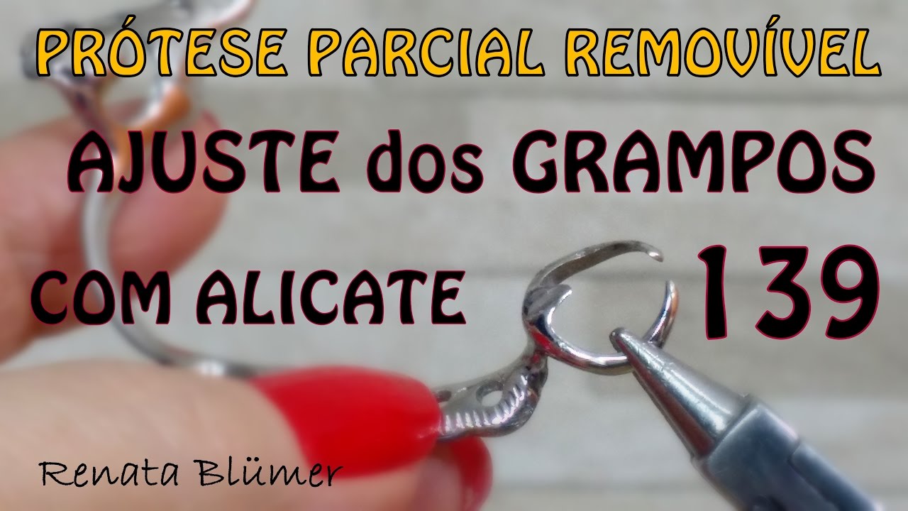 AJUSTE DOS GRAMPOS EM UMA PPR COM ALICATE 139