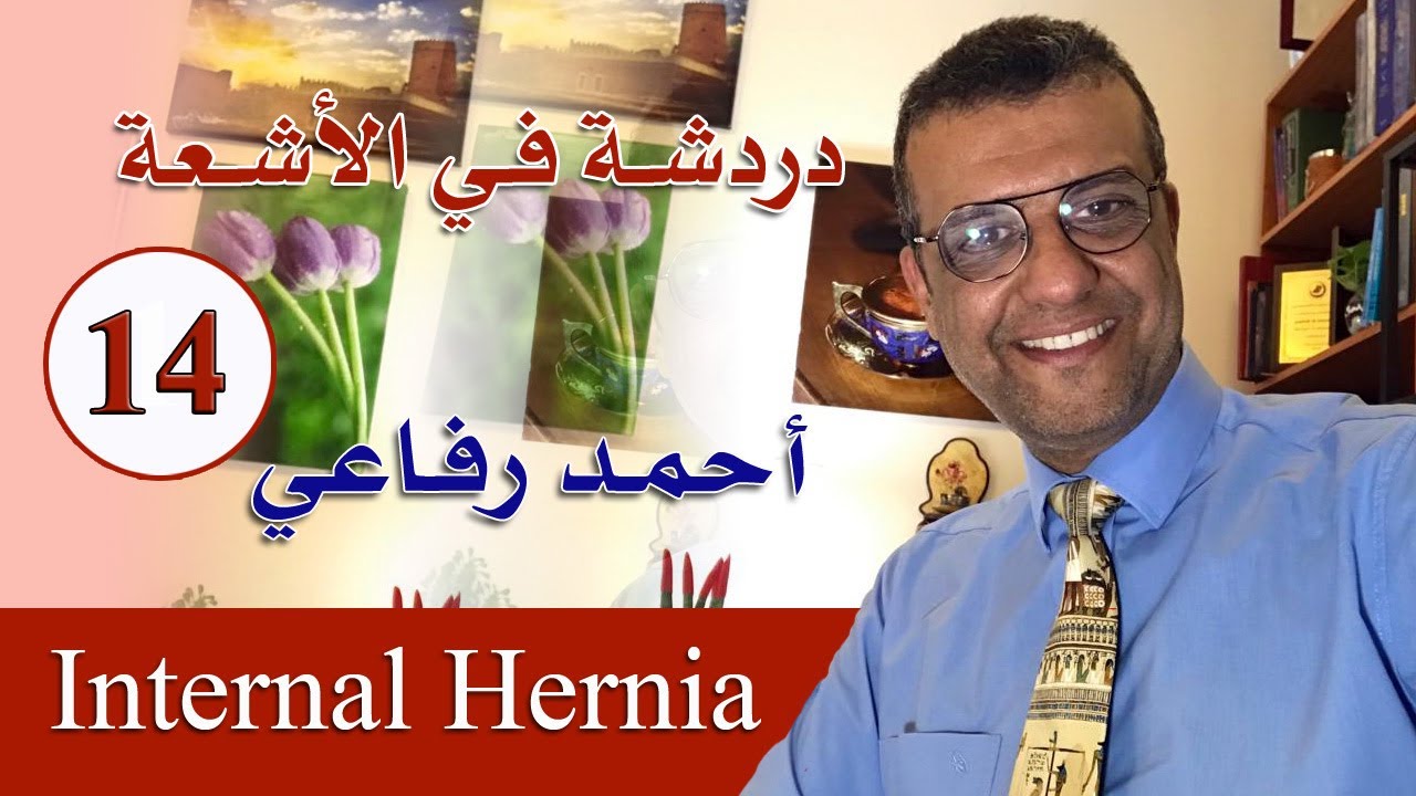 دردشة فى الاشعة 14 - Internal hernia - د. أحمد رفاعي