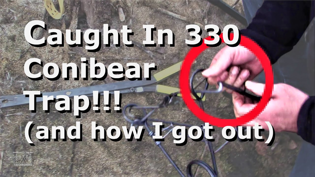 Рука попалась в ловушку для медведей Coniber Trap 330!!! (и как я выбралась)