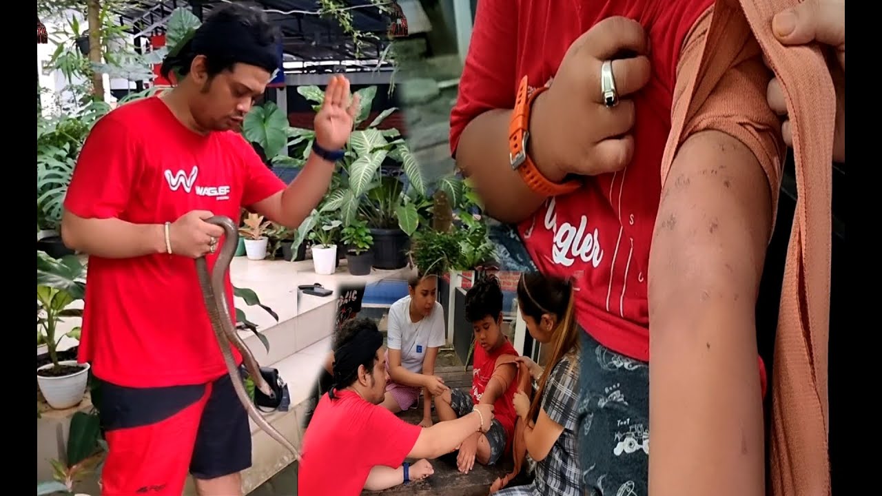 AUFA DI GIGIT COBRA NYASAR MASUK RUMAH ! GINI KONDISINYA SEKARANG