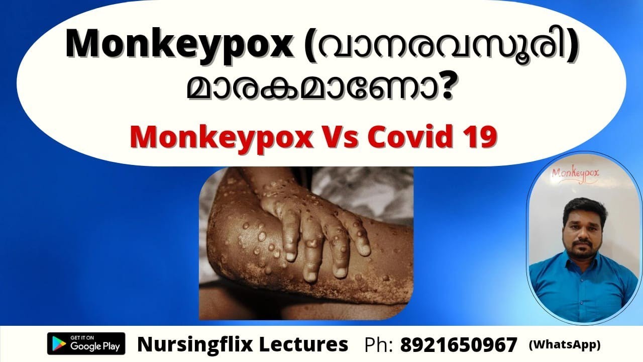 Monkeypox (വാനരവസൂരി) മാരകമാണോ? l അറിയേണ്ടതെല്ലാം