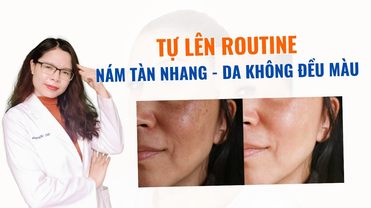 Cách tự lên quy trình chăm sóc da nám tàn nhang - da không đều màu - Bác sĩ Nguyên