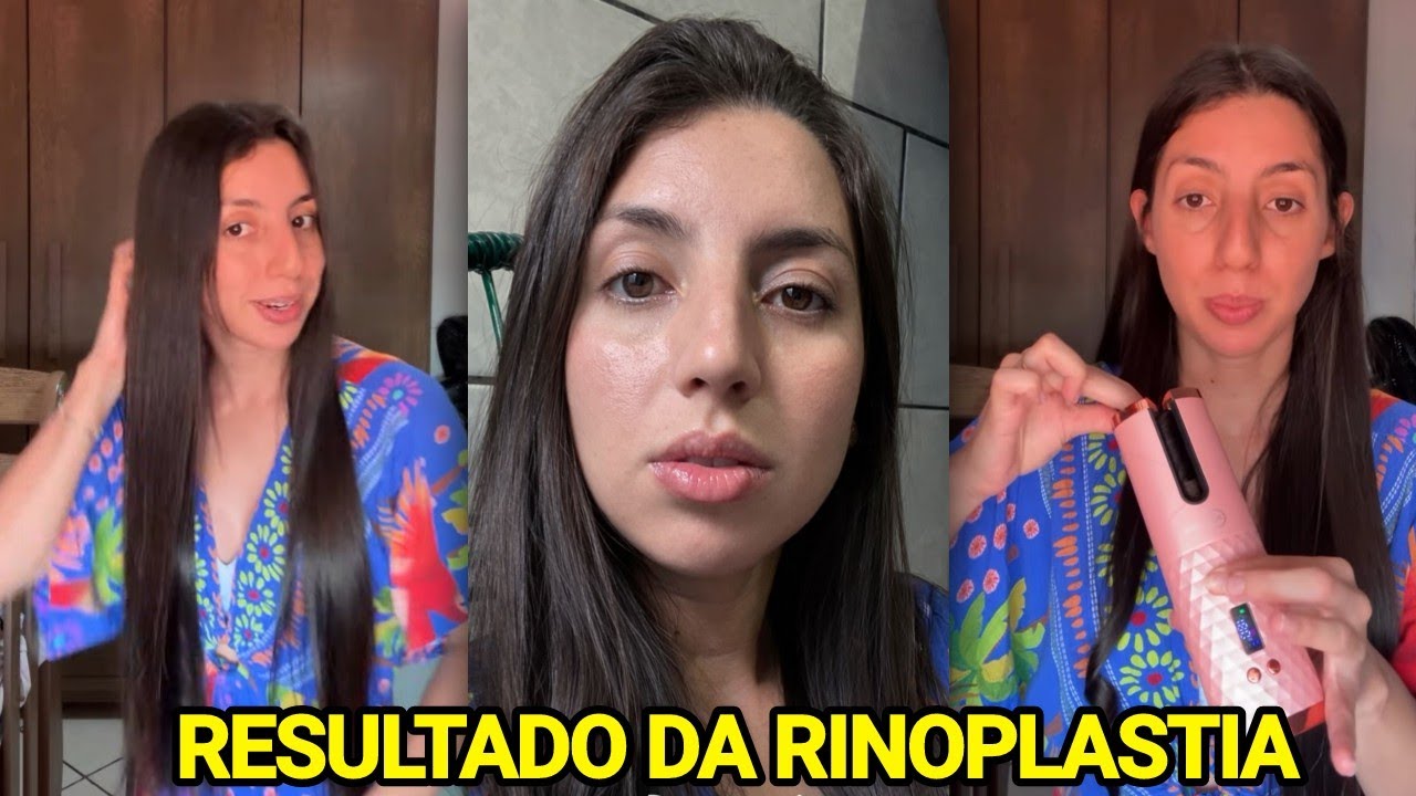 SARA KELLEN DESABAFA E MOSTRA SIMULAÇÕES DA RINOPLASTIA DO NARIZ