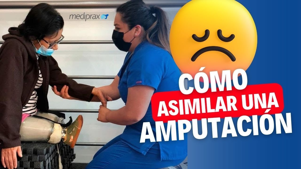 C&oacute;mo adaptarse a la p&eacute;rdida de una extremidad: Aceptar los cambios f&iacute;sicos tras la amputaci&oacute;n