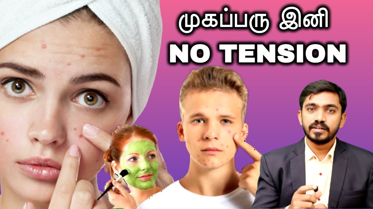 பளிச் முகம் முகப்பரு  இயற்க்கை மருத்துவம் | CURE PIMPLES NATURALLY IN TAMIL