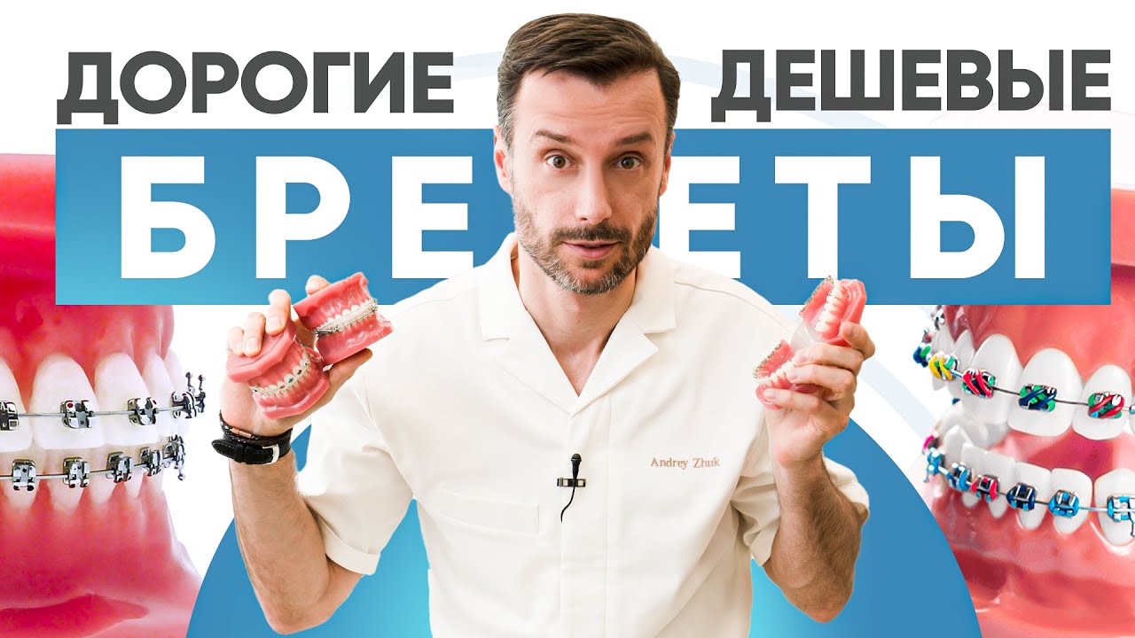 Самые дорогие и самые дешевые брекеты – в чем разница?