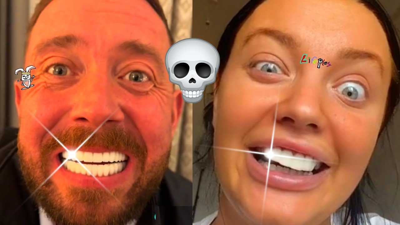 TURKEY TEETH FAILS - VENEER FAILS [FULL COMPILATION] 😬