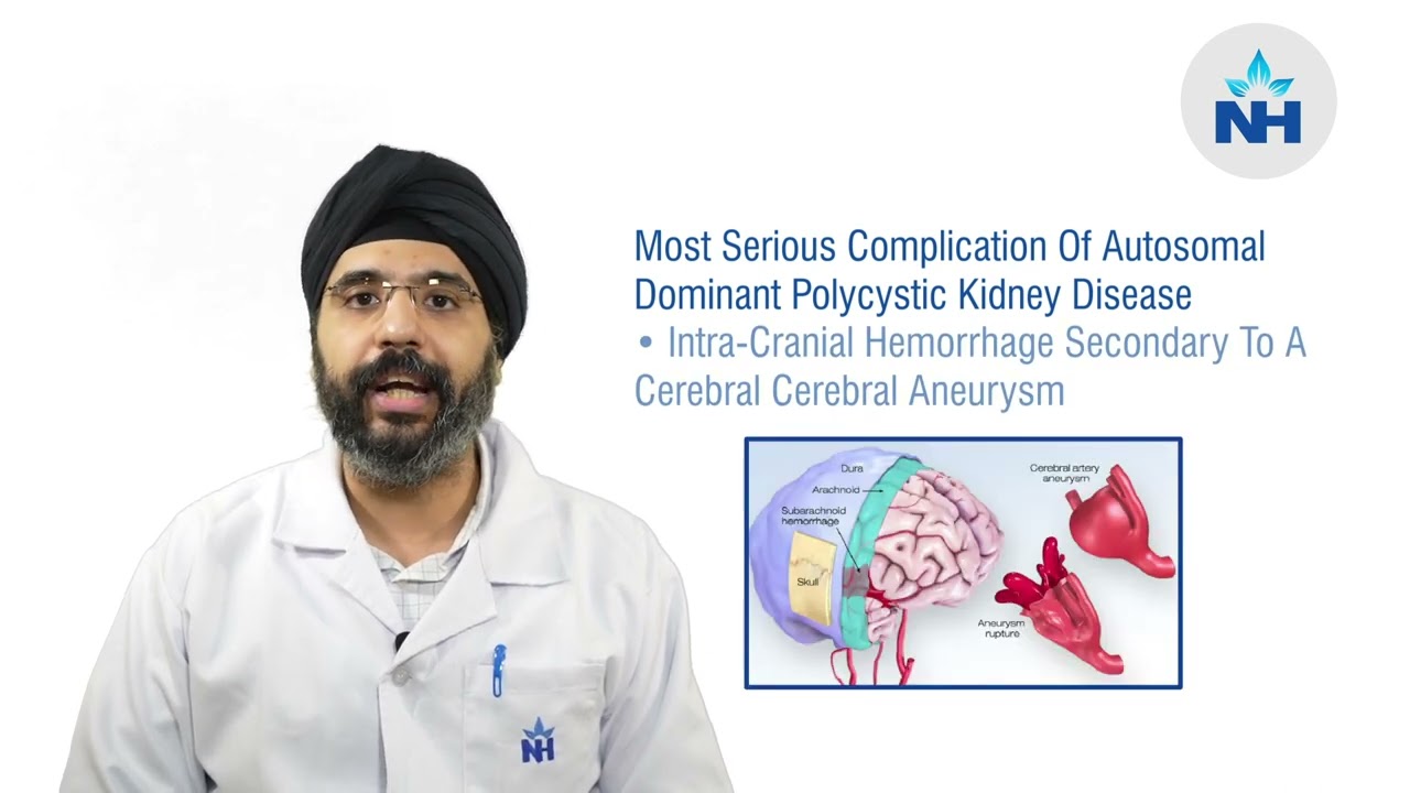 Complications Of Autosomal Dominant Polycystic Kidney Disease | Dr. Sudeep Singh Sachdev