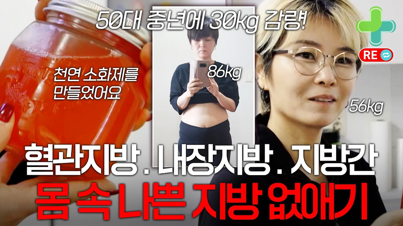 [라이브 다시보기] 혈관지방.내장지방.지방간 몸 속 나쁜 지방 빼는 방법