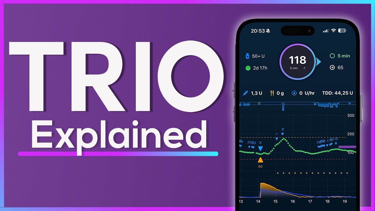 Trio Explained: Dynamic Automated Insulin Delivery