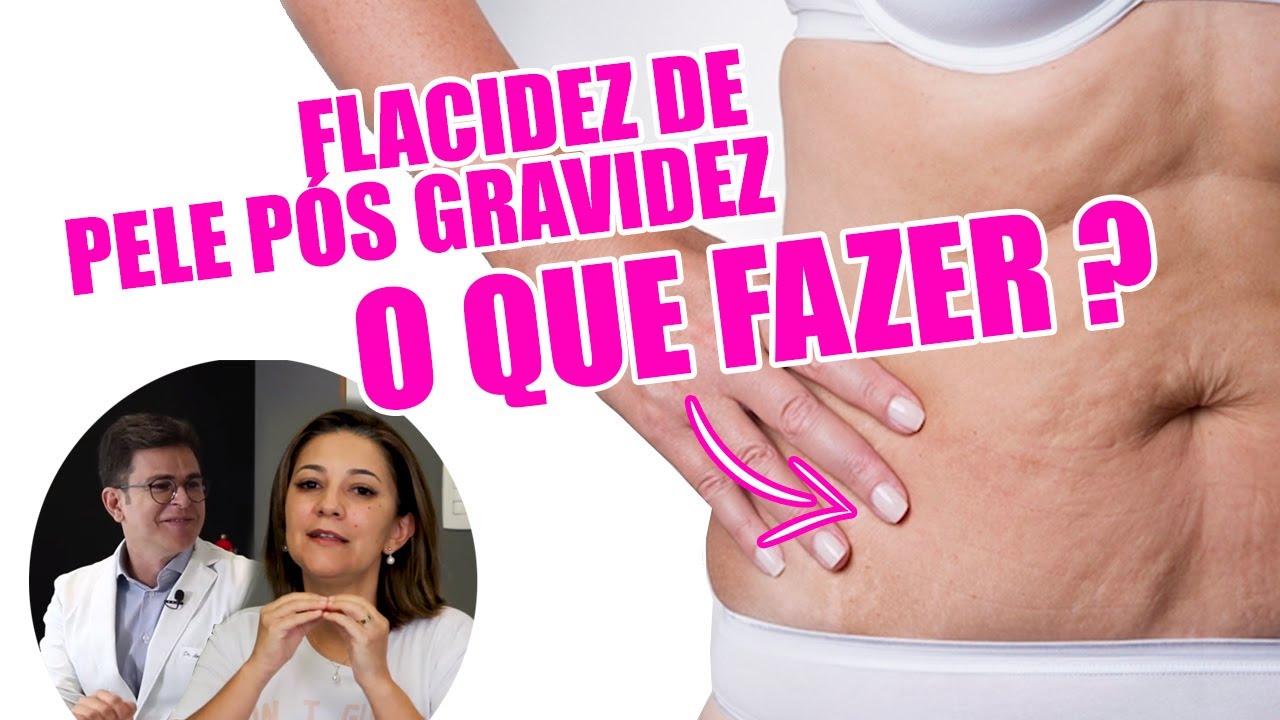 Flacidez de pele e barriga pós gravidez - o que fazer?