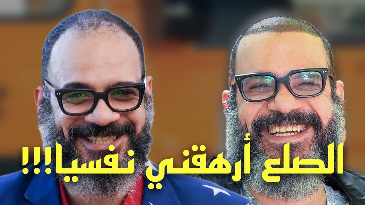 ندمت أني ما زرعت قبل! تجربتي مع زراعة الشعر بعد 10 أيام